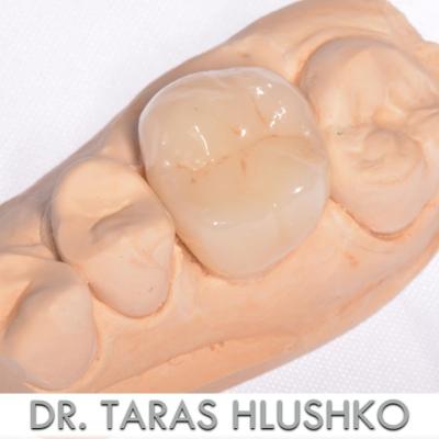 Protezuvannia Na Zubakh V003 002