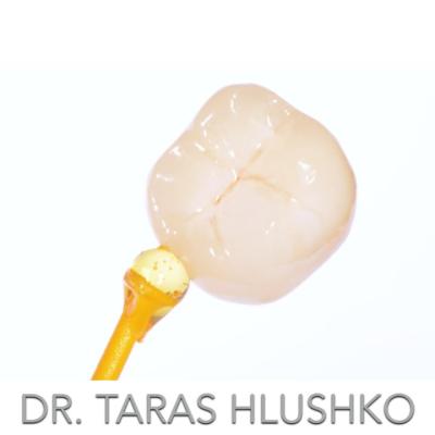 Protezuvannia Na Zubakh V004 001