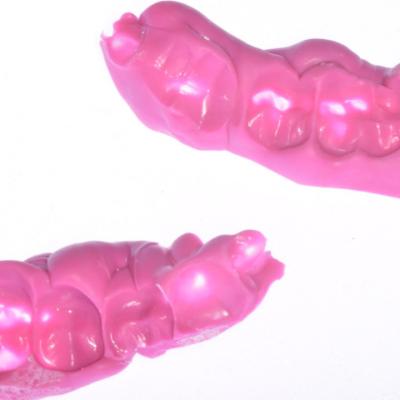 Protezuvannia Na Zubakh Ta Implantakh V004 003