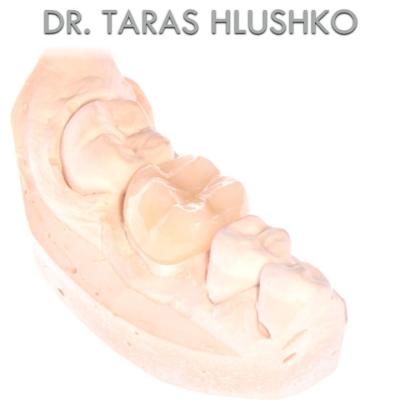 Protezuvannia Na Zubakh V005 I001