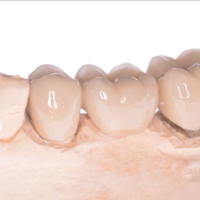 Protezuvannia Na Zubakh V006 I005