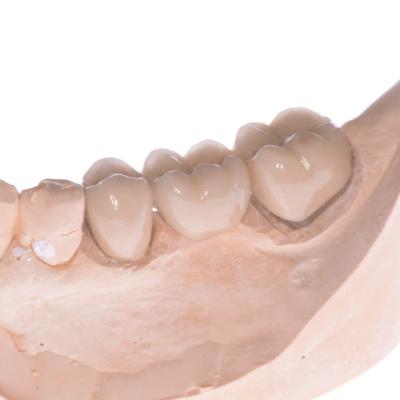 Protezuvannia Na Zubakh V006 I006