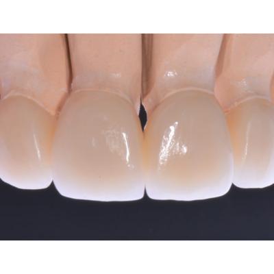 Protezuvannia Na Zubakh V007 I001