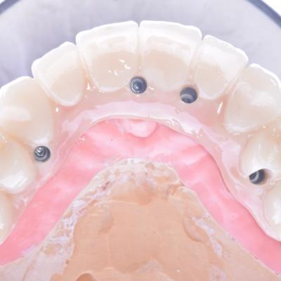 Protezuvannia Na Implantakh V6 I3