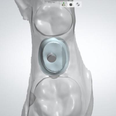 Protezuvannia Na Implantakh V7 I8