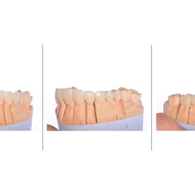 Protezuvannia Na Zubakh V9 I3