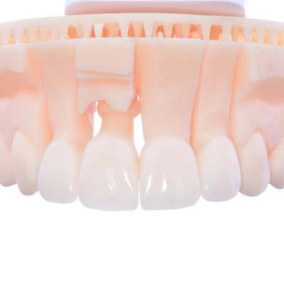 Protezuvannia Na Zubakh Ta Implantakh V7 I1