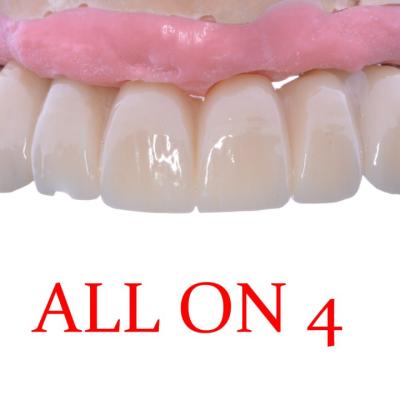 Protezuvannia Na Implantakh V9 I2