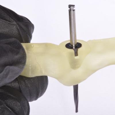 Protezuvannia Na Implantakh V003 001